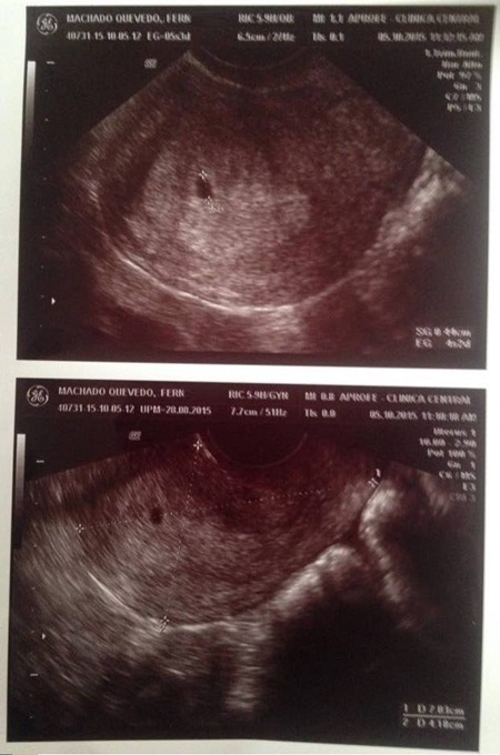 พ่อ-แม่ข้ามเพศคู่แรกของอเมริกาใต้ พ่อ-แม่ข้ามเพศคู่แรกของอเมริกาใต้