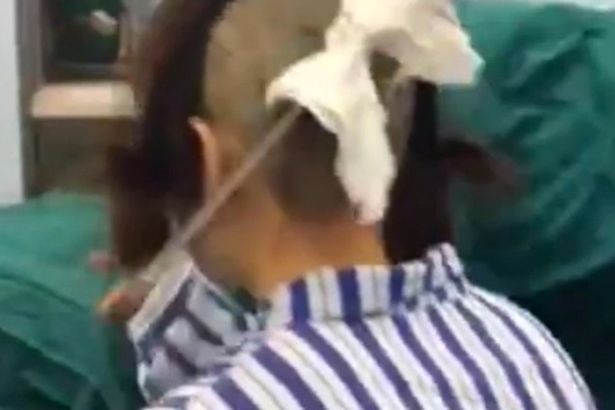 เมียหลวงจับได้ผัวแอบมีกิ๊ก ฟาดปังตอปักคาหัว เมียหลวงจับได้ผัวแอบมีกิ๊ก ฟาดปังตอปักคาหัว