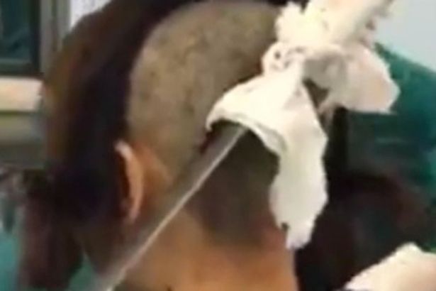 เมียหลวงจับได้ผัวแอบมีกิ๊ก ฟาดปังตอปักคาหัว เมียหลวงจับได้ผัวแอบมีกิ๊ก ฟาดปังตอปักคาหัว