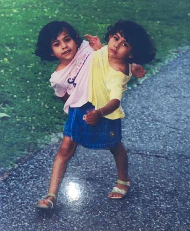 ฝาแฝดตัวติดกัน ฝาแฝดตัวติดกัน