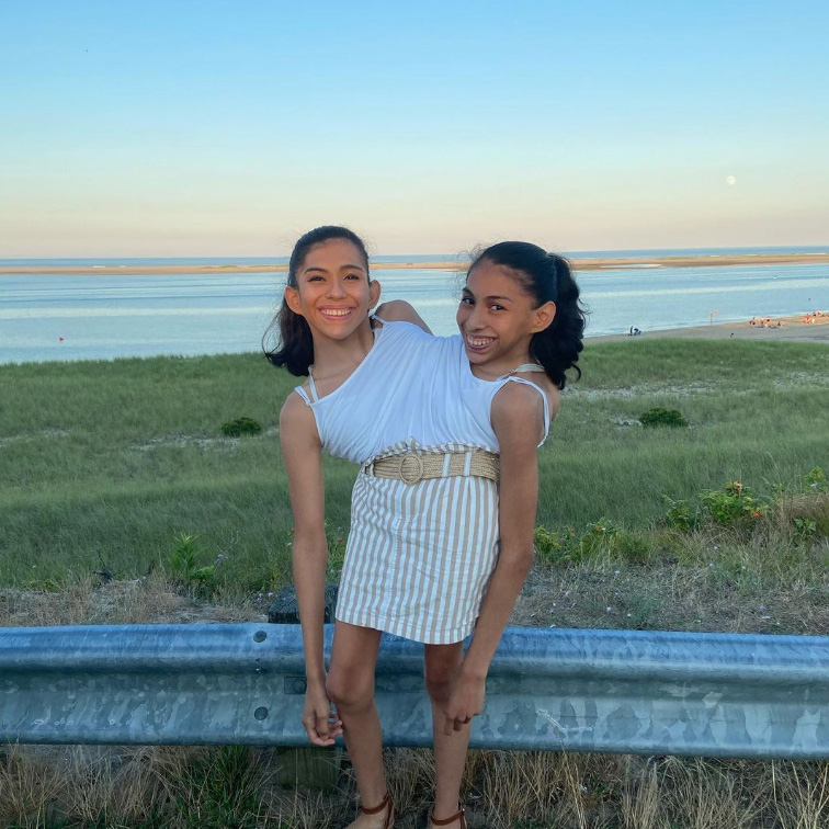 ฝาแฝดตัวติดกัน ฝาแฝดตัวติดกัน