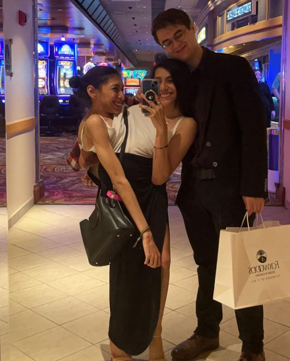 ฝาแฝดตัวติดกัน ฝาแฝดตัวติดกัน