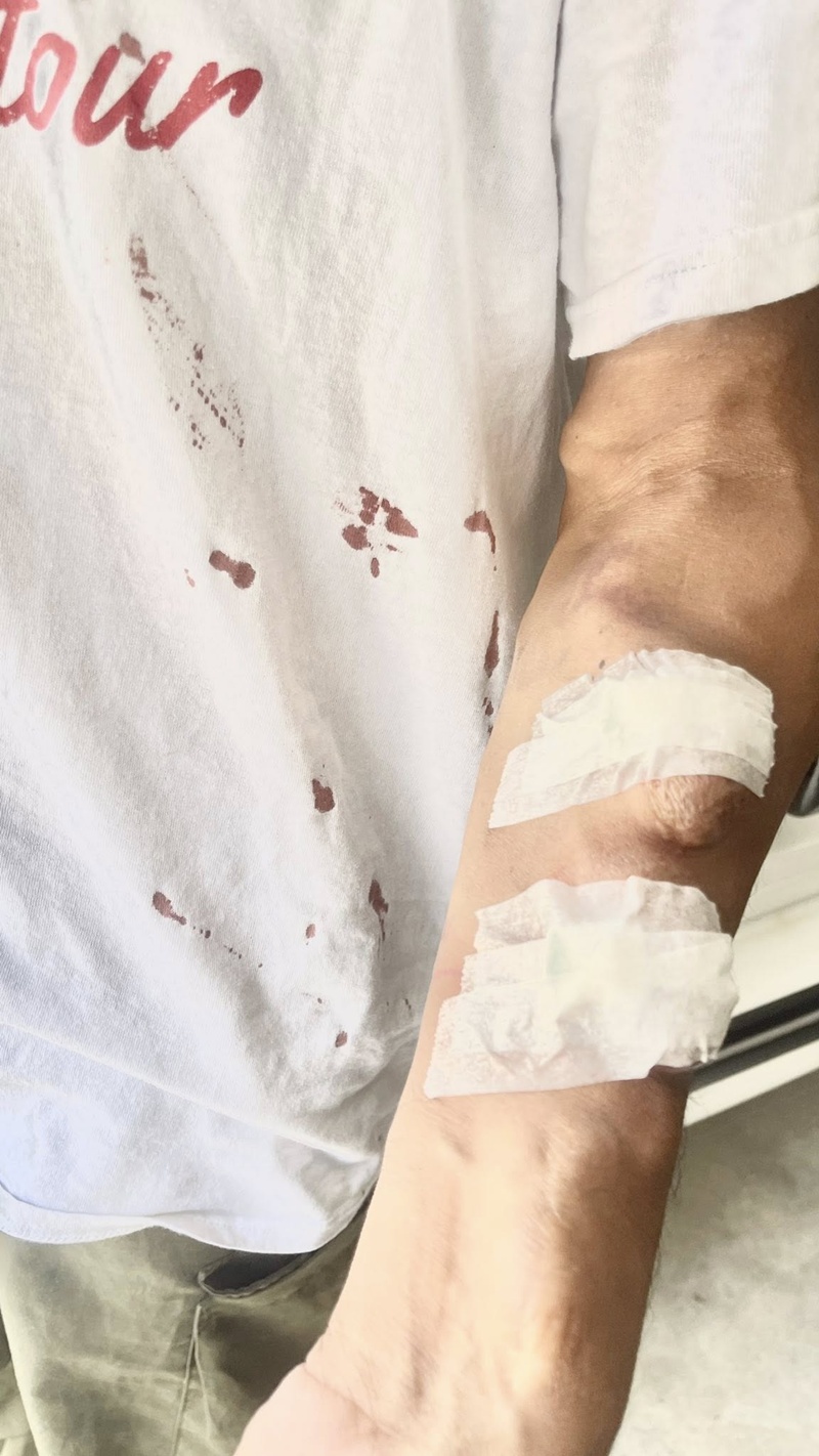 ผู้ป่วยฟอกไต ร้องเจอหัวหน้าพยาบาลเหวี่ยง ผู้ป่วยฟอกไต ร้องเจอหัวหน้าพยาบาลเหวี่ยง