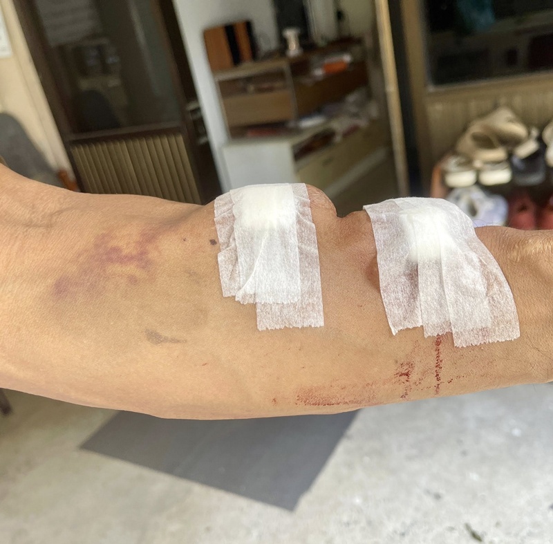 ผู้ป่วยฟอกไต ร้องเจอหัวหน้าพยาบาลเหวี่ยง ผู้ป่วยฟอกไต ร้องเจอหัวหน้าพยาบาลเหวี่ยง