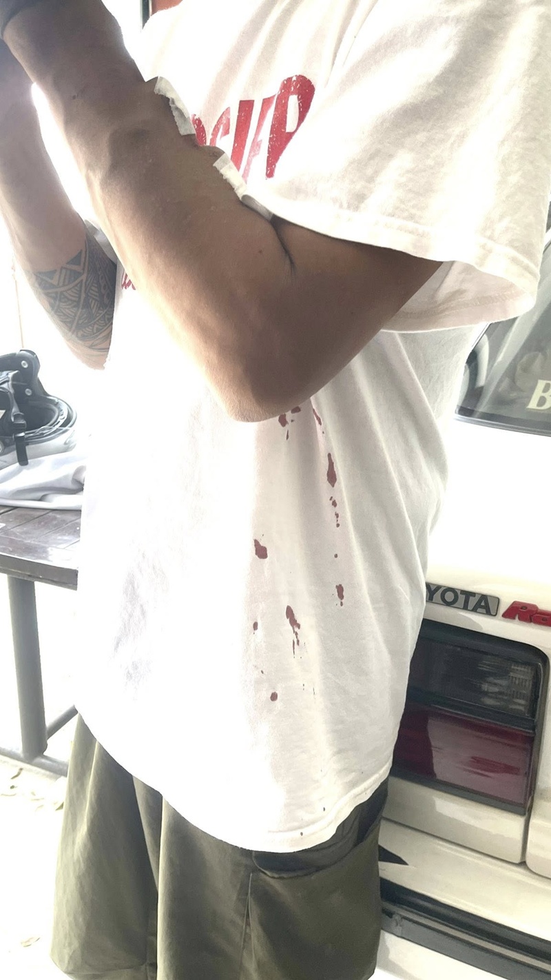 ผู้ป่วยฟอกไต ร้องเจอหัวหน้าพยาบาลเหวี่ยง ผู้ป่วยฟอกไต ร้องเจอหัวหน้าพยาบาลเหวี่ยง