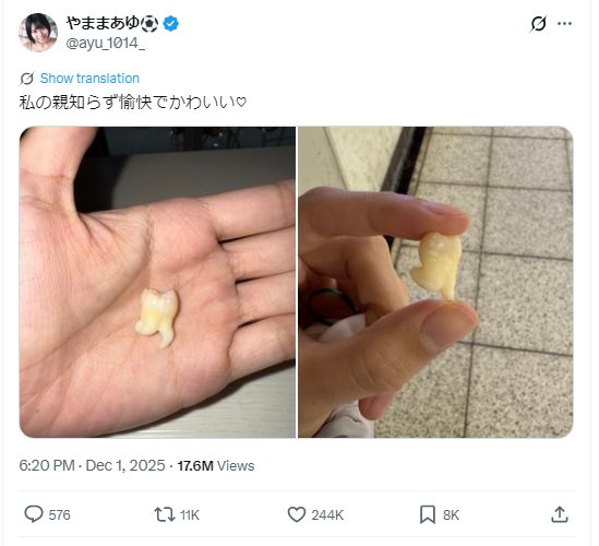 ภาพฟันคุดสาวญี่ปุ่น กลายเป็นไวรัล 17 ล้าน ภาพฟันคุดสาวญี่ปุ่น กลายเป็นไวรัล 17 ล้าน