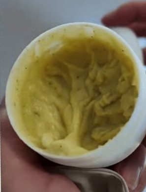 หญิงจีนเผยสภาพหลังลายราวกับหนังงู ต้นเหตุจากใช้ยาแก้คัน หญิงจีนเผยสภาพหลังลายราวกับหนังงู ต้นเหตุจากใช้ยาแก้คัน