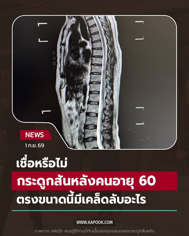กระดูกสันหลัง กระดูกสันหลัง