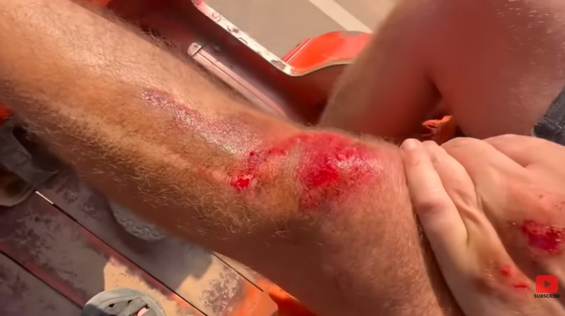 นักท่องเที่ยวต่างชาติ ถูกทำร้ายในนครวัด นักท่องเที่ยวต่างชาติ ถูกทำร้ายในนครวัด