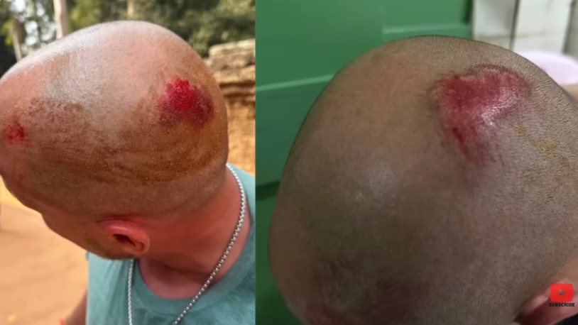 นักท่องเที่ยวต่างชาติ ถูกทำร้ายในนครวัด นักท่องเที่ยวต่างชาติ ถูกทำร้ายในนครวัด