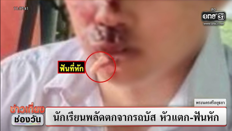 นักเรียนตกจากรถบัสโดยสาร นักเรียนตกจากรถบัสโดยสาร