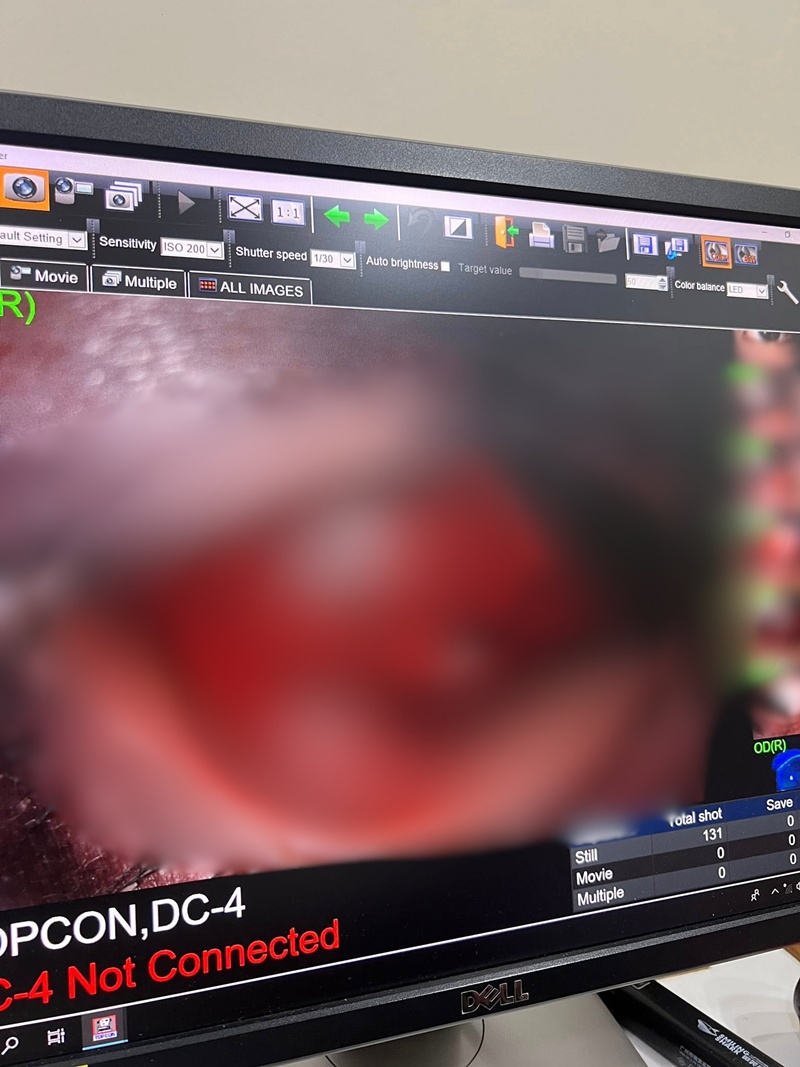 หนุ่มโดนชกหน้าตอนเที่ยวสงกรานต์ หนุ่มโดนชกหน้าตอนเที่ยวสงกรานต์