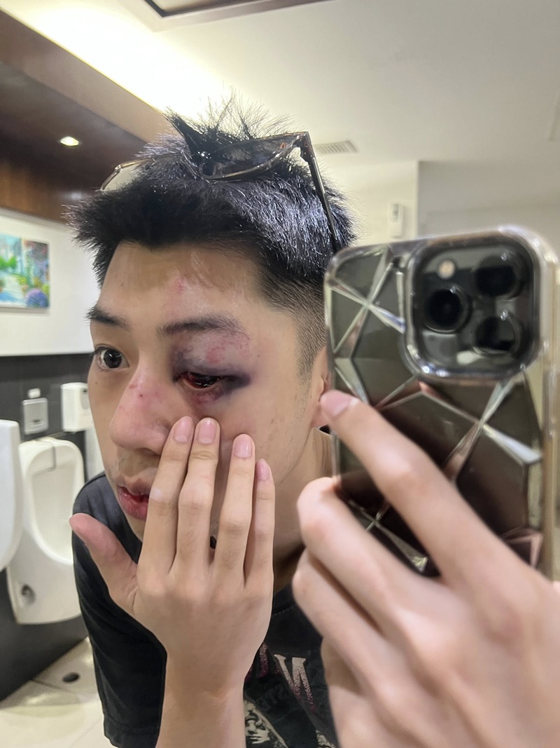 หนุ่มโดนชกหน้าตอนเที่ยวสงกรานต์ หนุ่มโดนชกหน้าตอนเที่ยวสงกรานต์