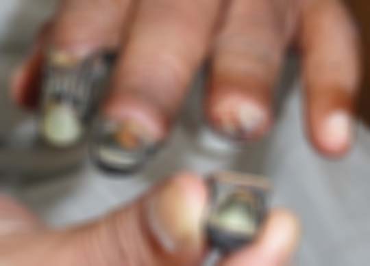 Krokodil ยาเสพติดมรณะ Krokodil ยาเสพติดมรณะ