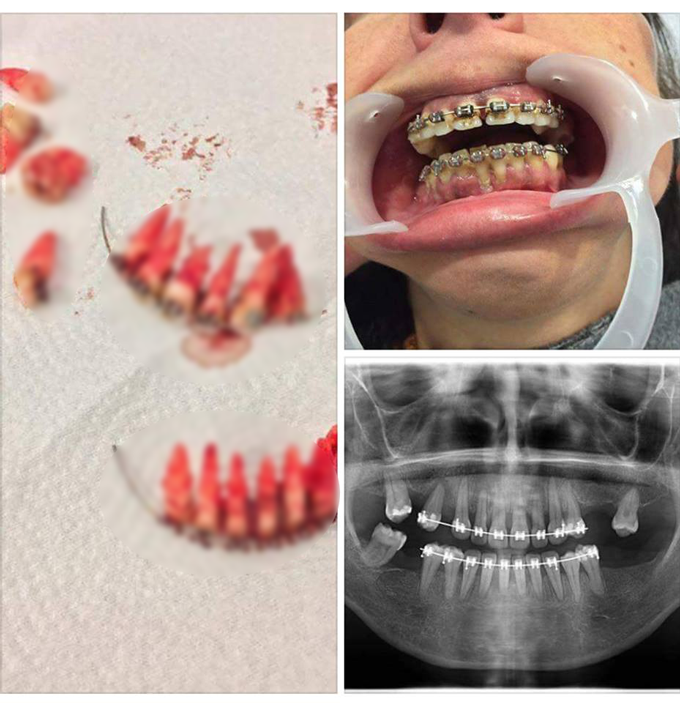 จัดฟันแฟชั่น จัดฟันแฟชั่น