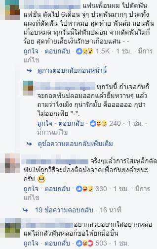 จัดฟันแฟชั่น จัดฟันแฟชั่น