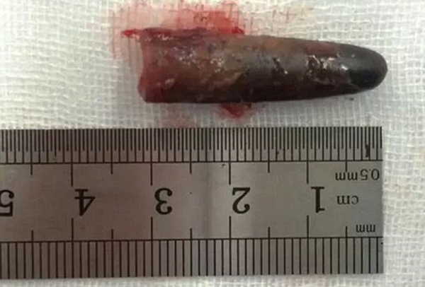 ปอดหาย ปอดหาย