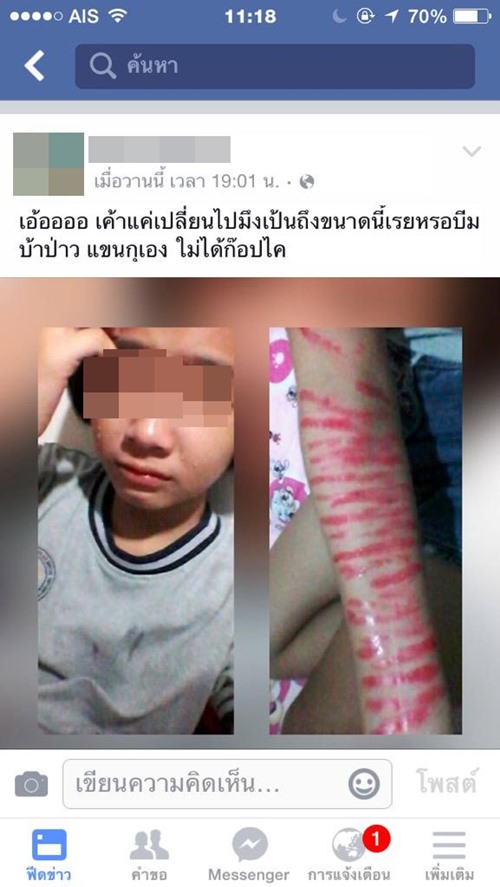 เด็กกรีดข้อมือ เด็กกรีดข้อมือ