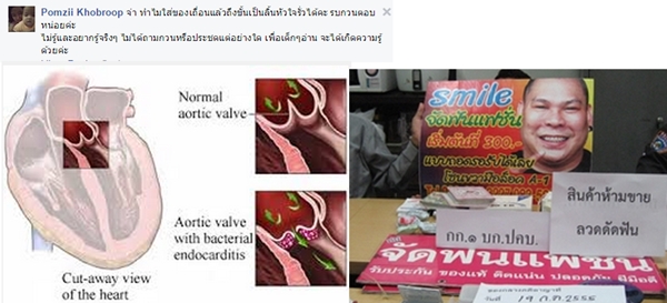 จัดฟันเถื่อน จัดฟันเถื่อน