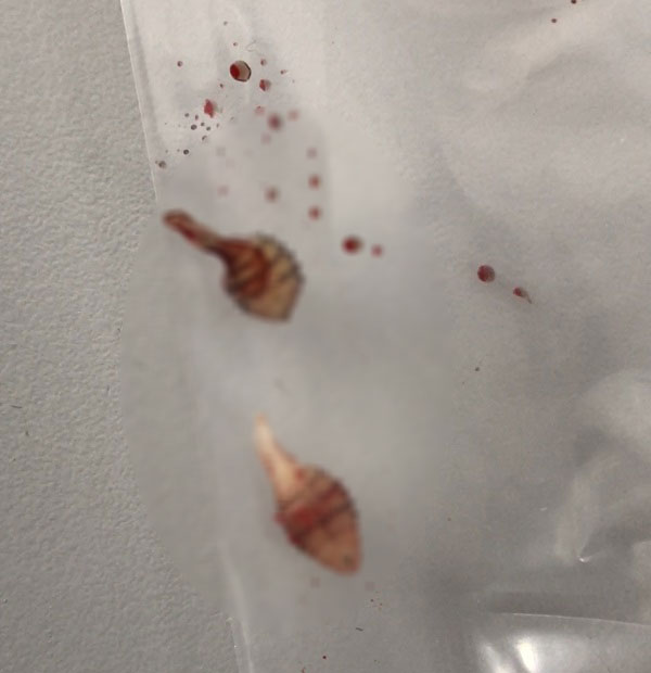 หนอนไชขา หนอนไชขา