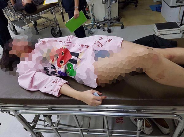 เสี่ยเอ็ม มินิแดง ซ้อมเมียท้อง เสี่ยเอ็ม มินิแดง ซ้อมเมียท้อง