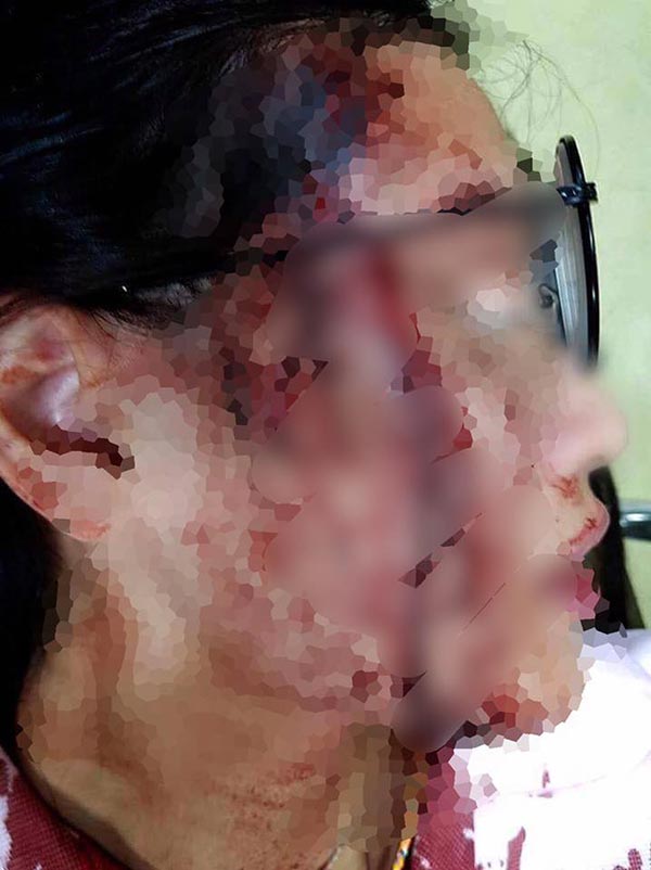 เสี่ยเอ็ม มินิแดง ซ้อมเมียท้อง เสี่ยเอ็ม มินิแดง ซ้อมเมียท้อง