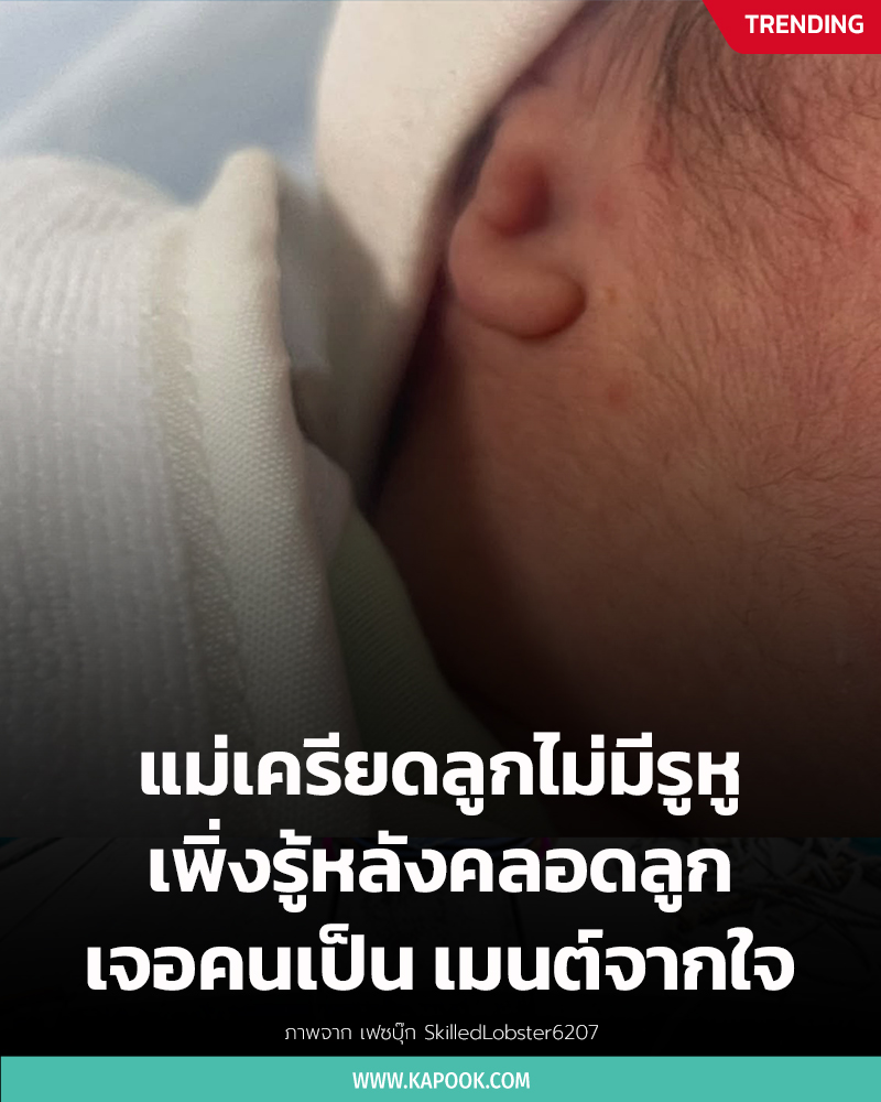 ไม่มีรูหู ไม่มีรูหู