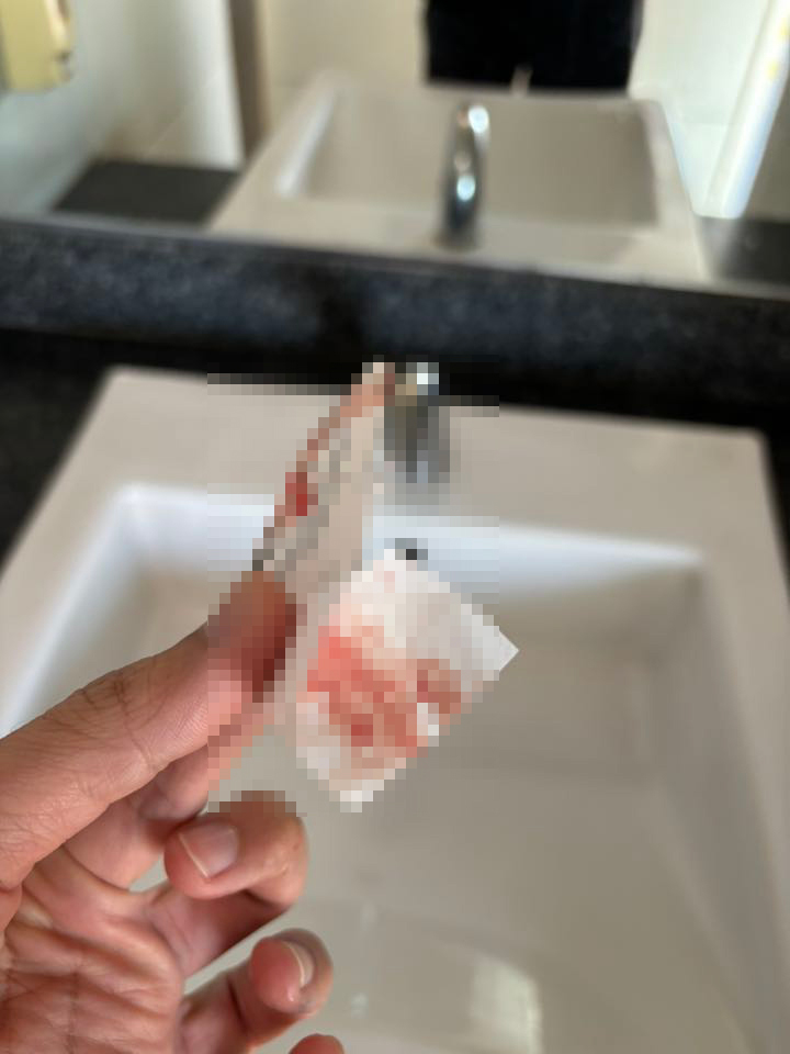 เลือดเปื้อนบน MRT เลือดเปื้อนบน MRT