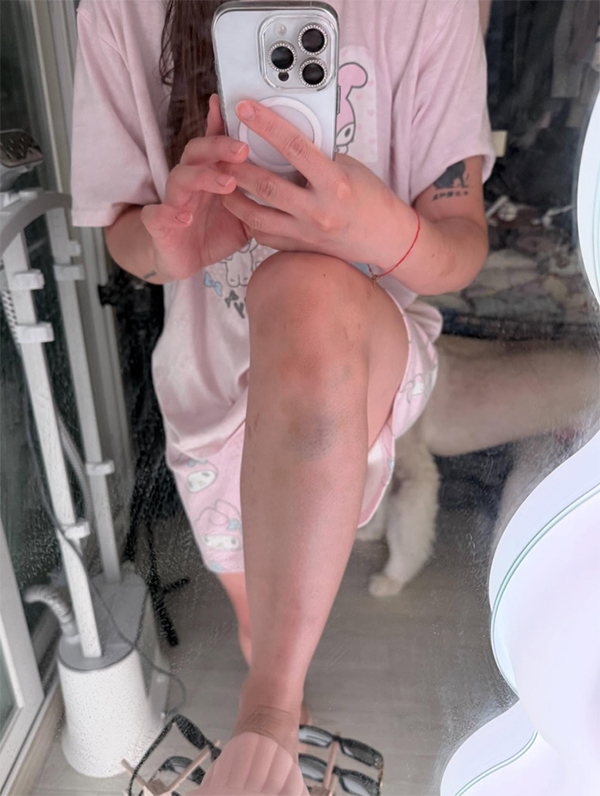 ยูทูบเบอร์ ถูกทำร้าย ยูทูบเบอร์ ถูกทำร้าย