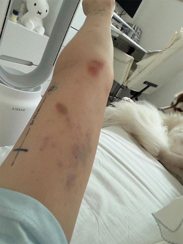 ยูทูบเบอร์ ถูกทำร้าย ยูทูบเบอร์ ถูกทำร้าย