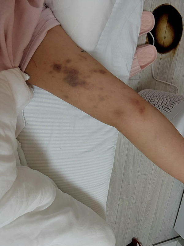 ยูทูบเบอร์ ถูกทำร้าย ยูทูบเบอร์ ถูกทำร้าย