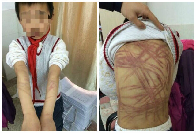 สั่งจำคุก 6 เดือนแม่บุญธรรมใจเหี้ยม เฆี่ยนลูกจนหลังลาย แค่ทำการบ้านไม่เสร็จ สั่งจำคุก 6 เดือนแม่บุญธรรมใจเหี้ยม เฆี่ยนลูกจนหลังลาย แค่ทำการบ้านไม่เสร็จ