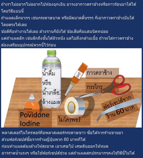 ใช้กาวตาช้างใส่แผล ใช้กาวตาช้างใส่แผล