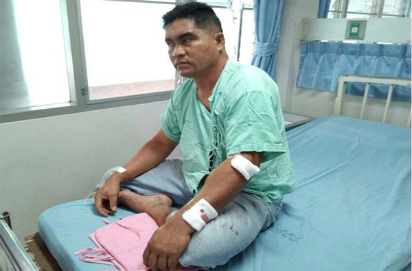 นักข่าวร้อยเอ็ด ถูกลอบยิง นักข่าวร้อยเอ็ด ถูกลอบยิง