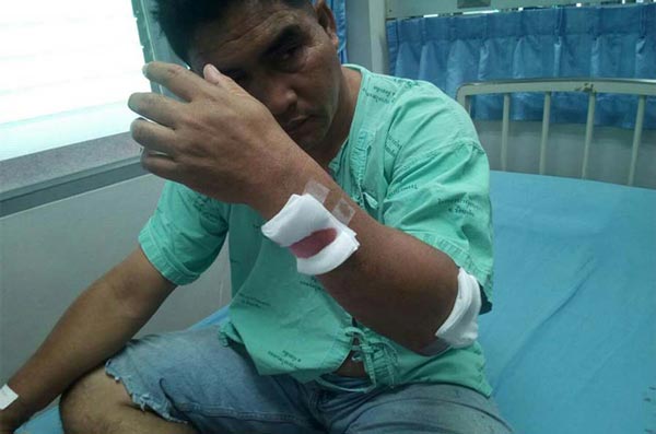 นักข่าวร้อยเอ็ด ถูกลอบยิง นักข่าวร้อยเอ็ด ถูกลอบยิง