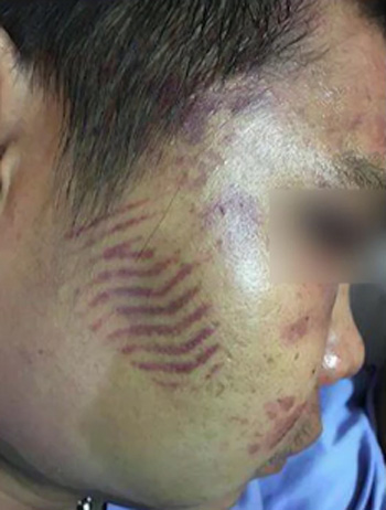 อาสาตำรวจรุมกระทืบ อาสาตำรวจรุมกระทืบ