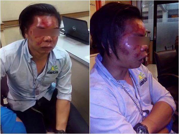 อาสาตำรวจรุมกระทืบ อาสาตำรวจรุมกระทืบ