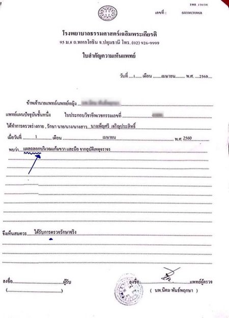 ฟอร์จูนเนอร์ชนจักรยาน ฟอร์จูนเนอร์ชนจักรยาน