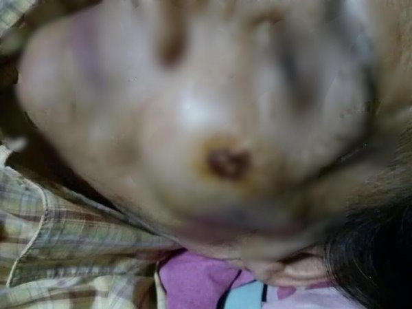 ฟอร์จูนเนอร์ชนจักรยาน ฟอร์จูนเนอร์ชนจักรยาน