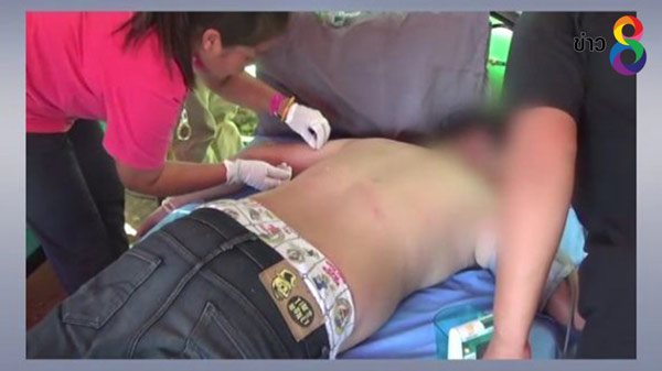 อาถรรพ์คำชะโนด หนุ่มลองดี เอาน้ำมนต์มาล้างเท้า เจอผึ้งนับร้อยรุมต่อยสาหัส อาถรรพ์คำชะโนด หนุ่มลองดี เอาน้ำมนต์มาล้างเท้า เจอผึ้งนับร้อยรุมต่อยสาหัส