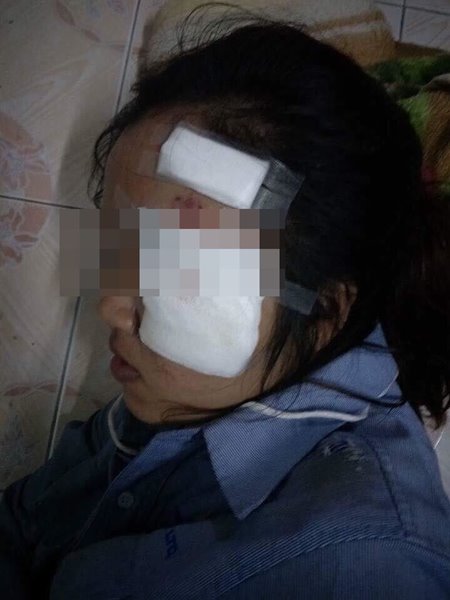 แป๊ก ปากหวาน แป๊ก ปากหวาน