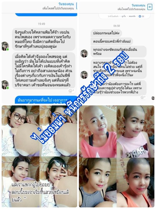 เพจดังแฉ สาวเป็นมะเร็งที่หน้า เพจดังแฉ สาวเป็นมะเร็งที่หน้า