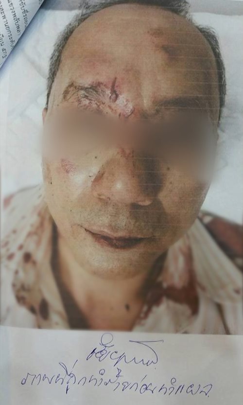 ข่าวอ.แทงบิ๊กไบค์ ข่าวอ.แทงบิ๊กไบค์