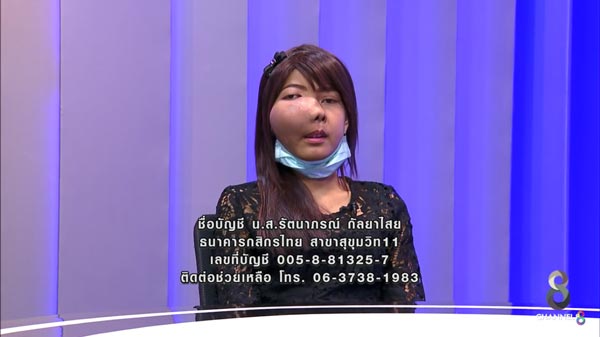 เพจดังแฉ สาวเป็นมะเร็งที่หน้า เพจดังแฉ สาวเป็นมะเร็งที่หน้า