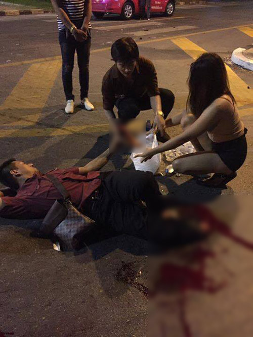 แท็กซี่เฉี่ยวเท้าขาด แท็กซี่เฉี่ยวเท้าขาด