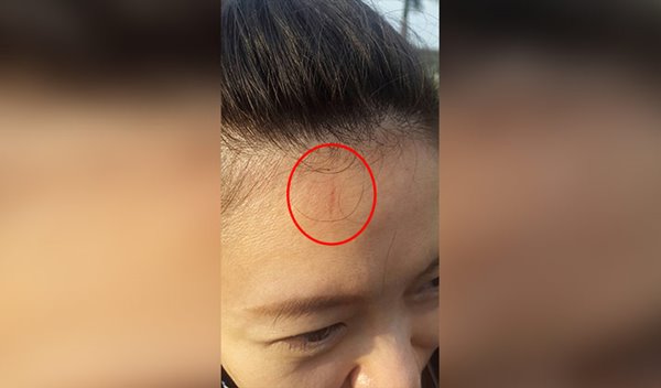 รถบัสทัพสควอชหญิงซีเกมส์ไทย ชนสนั่นกับทีมพม่า บาดเจ็บเล็กน้อย รถบัสทัพสควอชหญิงซีเกมส์ไทย ชนสนั่นกับทีมพม่า บาดเจ็บเล็กน้อย