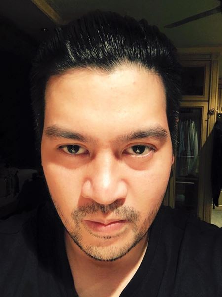 ต๊อด ปิติ เข้าช่วยเหลือ เด็ก 2 ขวบถูกสุนัขรุมกัดไส้ไหล ต๊อด ปิติ เข้าช่วยเหลือ เด็ก 2 ขวบถูกสุนัขรุมกัดไส้ไหล