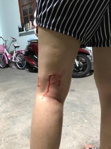 หมาจรจัดไล่กัดคน หมาจรจัดไล่กัดคน