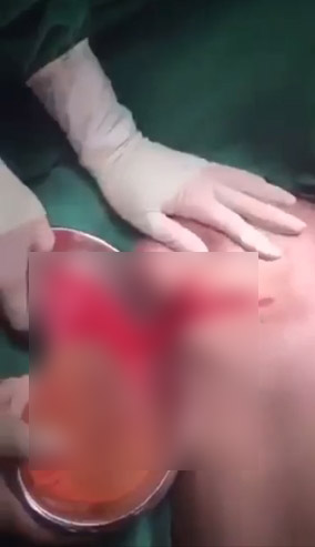 ศัลยกรรมทำพิษ ศัลยกรรมทำพิษ