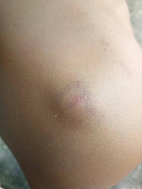 รุ่นพี่ทำร้ายรุ่นน้อง รุ่นพี่ทำร้ายรุ่นน้อง